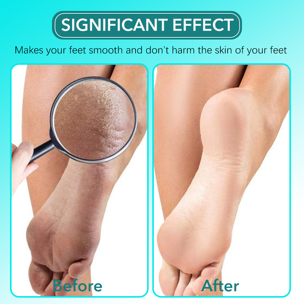 2Pcs/set Glass Foot File Set C - đánh giá và giá Skincare Ingredients Checker