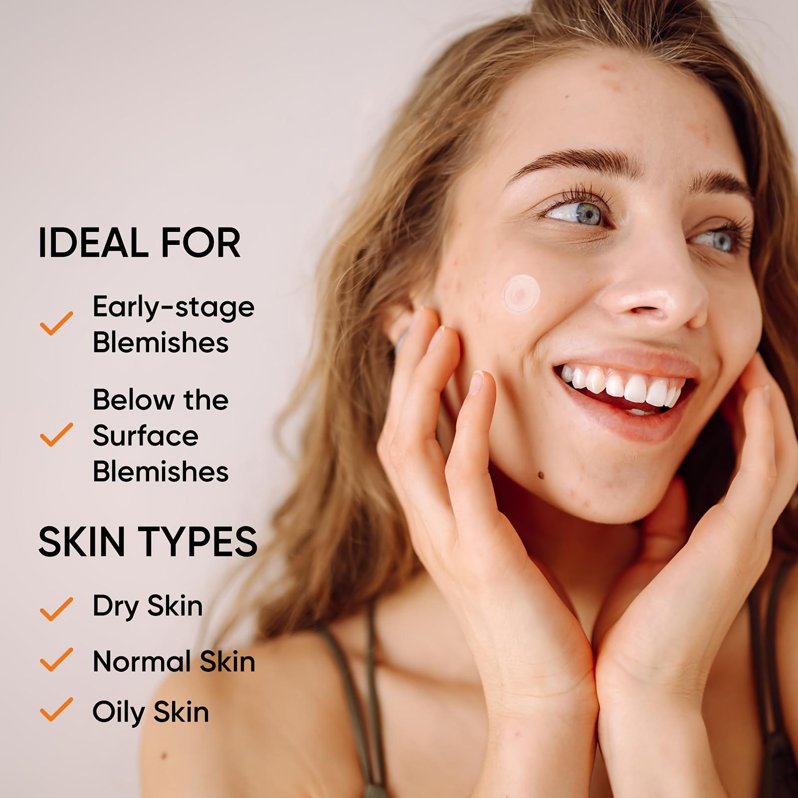 Large Hydrogel Acne Patches Xl - đánh giá và giá Xl Skincare