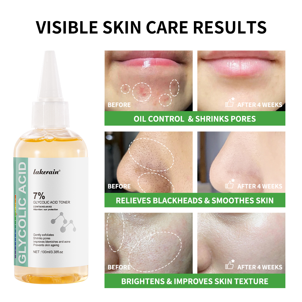 Glycolic Acid 7% Toning Soluti - đánh giá và giá Lactic Acid Toner
