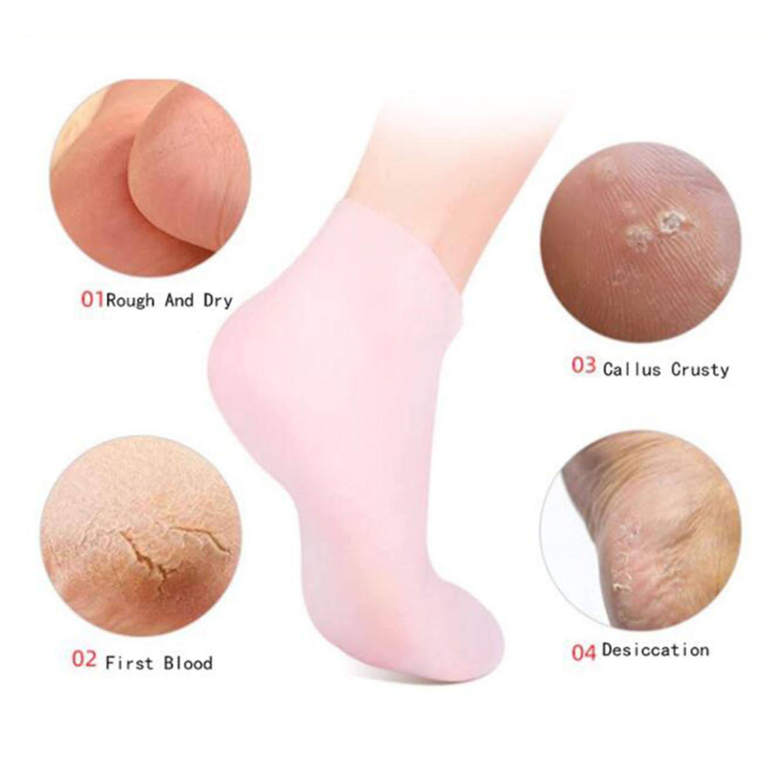 Soft Silicone Gel Socks Toe So - đánh giá và giá Xl Skincare