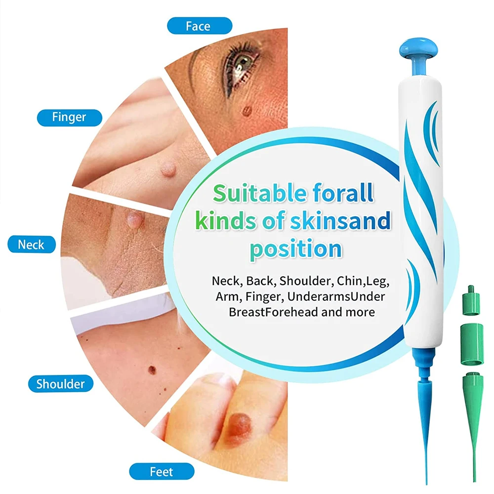 2 IN 1 Auto Micro Skin Tag Rem - đánh giá và giá Skincare Ingredients Checker