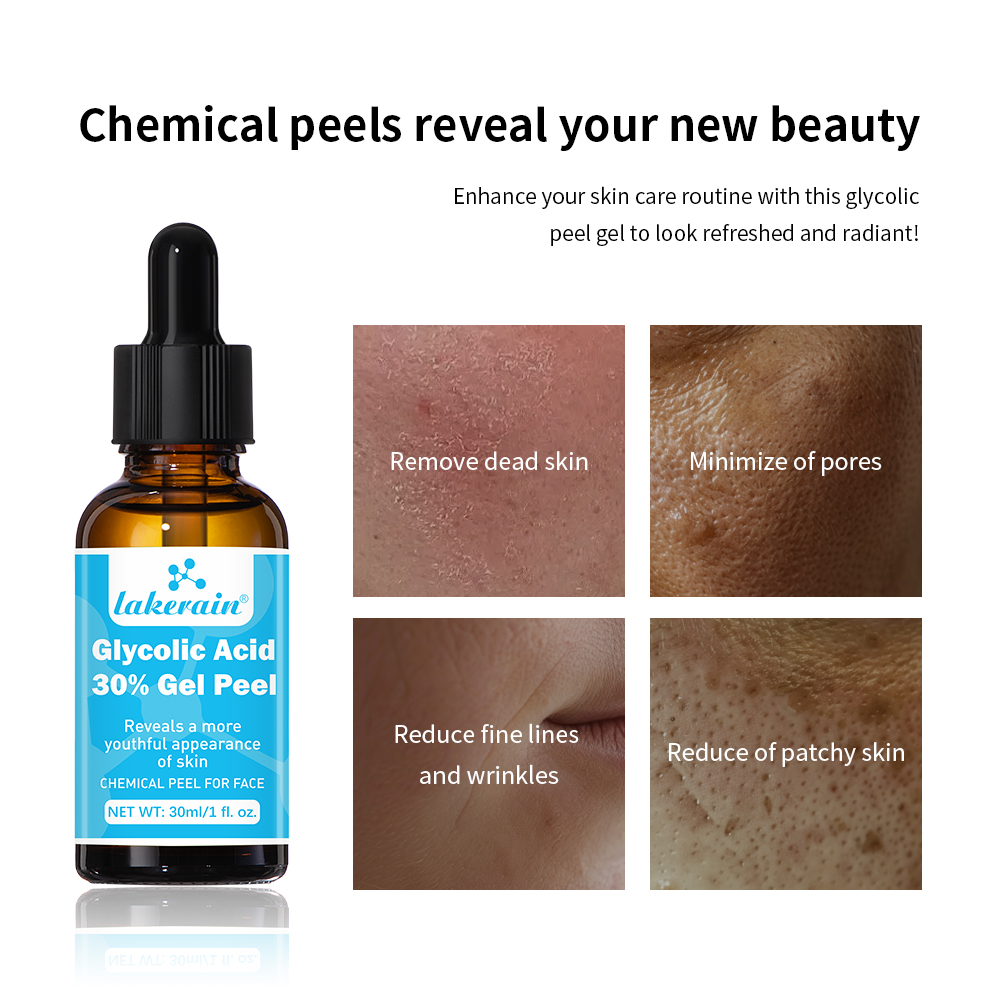 30% Glycolic Acid Peel Gel Pro - đánh giá và giá Lactic Acid Toner
