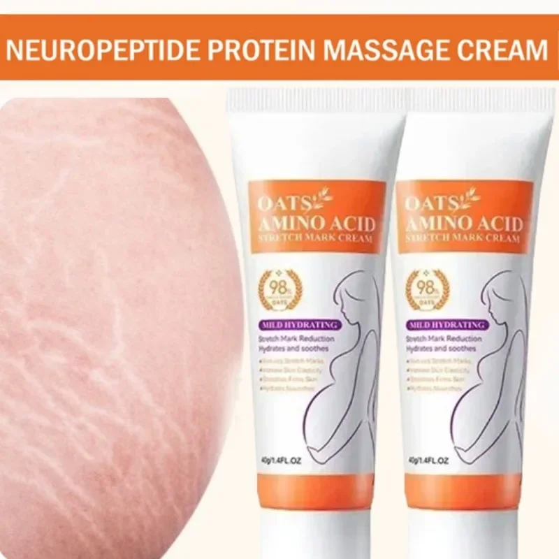 Stretch Marks Permanent Remova - đánh giá và giá Skincare Oat