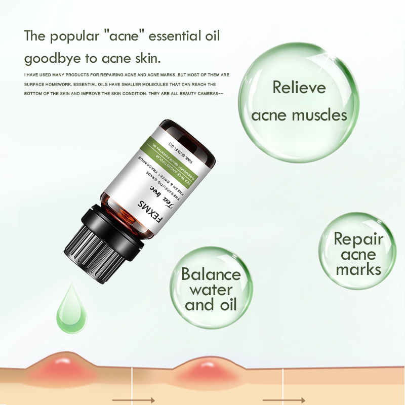 100% Nguyên Chất Tinh Dầu Cây  - đánh giá và giá Tea Tree Spot Treatment