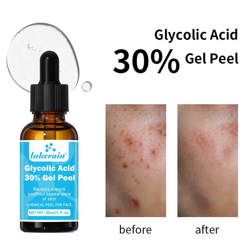 30% Glycolic Acid Peel Gel Pro - đánh giá và giá Lactic Acid Toner