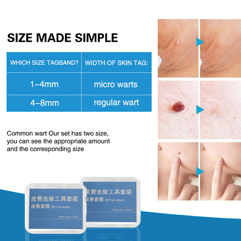 20pcs/Box Flesh Nevus Removal  - đánh giá và giá Skincare Ingredients Checker