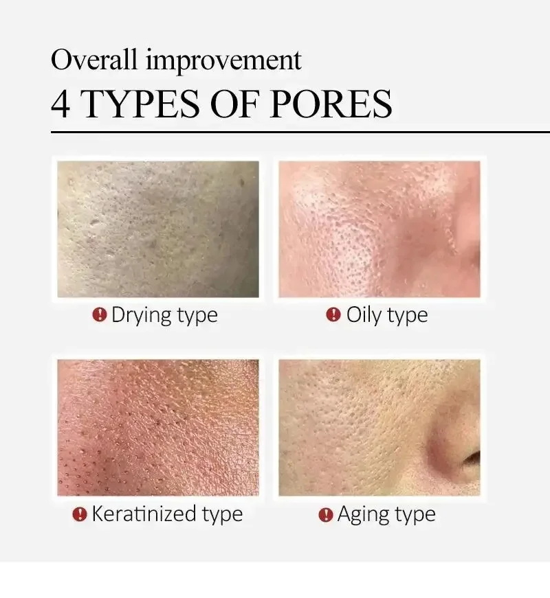 Centella Asiatica Shrink Pores - đánh giá và giá Centella Asiatica Toner