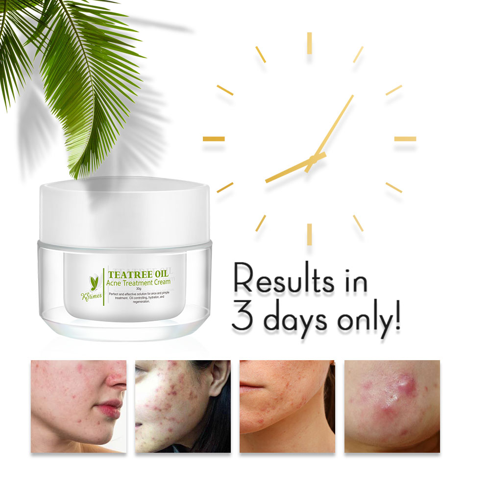 KStims Trị Mụn Tự Nhiên Chống  - đánh giá và giá Tea Tree Spot Treatment