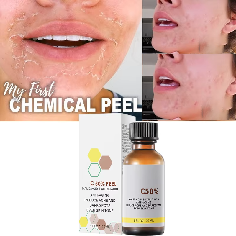 With Malic Acid And Citric Aci - đánh giá và giá Salicylic Acid Cleanser